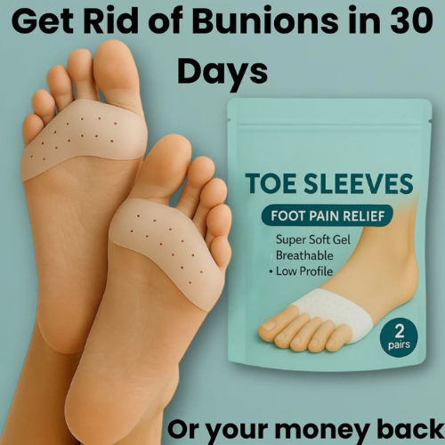 Before and after bunion correction using silicone toe sleeves, showing foot alignment improvement and pain relief