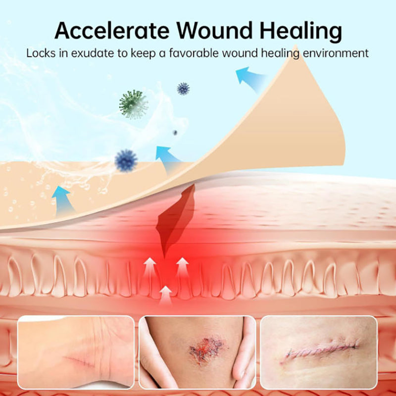 Hydrocolloid Roll for Wound Care – Self-Adhesive Absorbent Bandages
